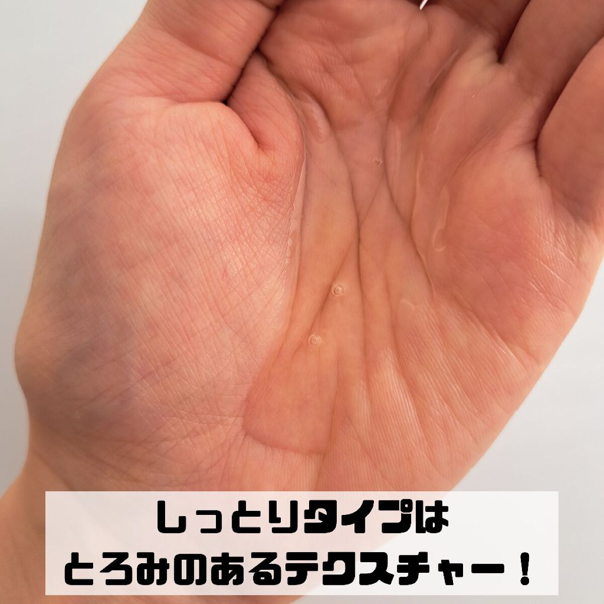 ダーマレーザー スーパーVC100ローション（しっとり） 240ml 【旧品】/クオリティファースト/化粧水を使ったクチコミ（2枚目）