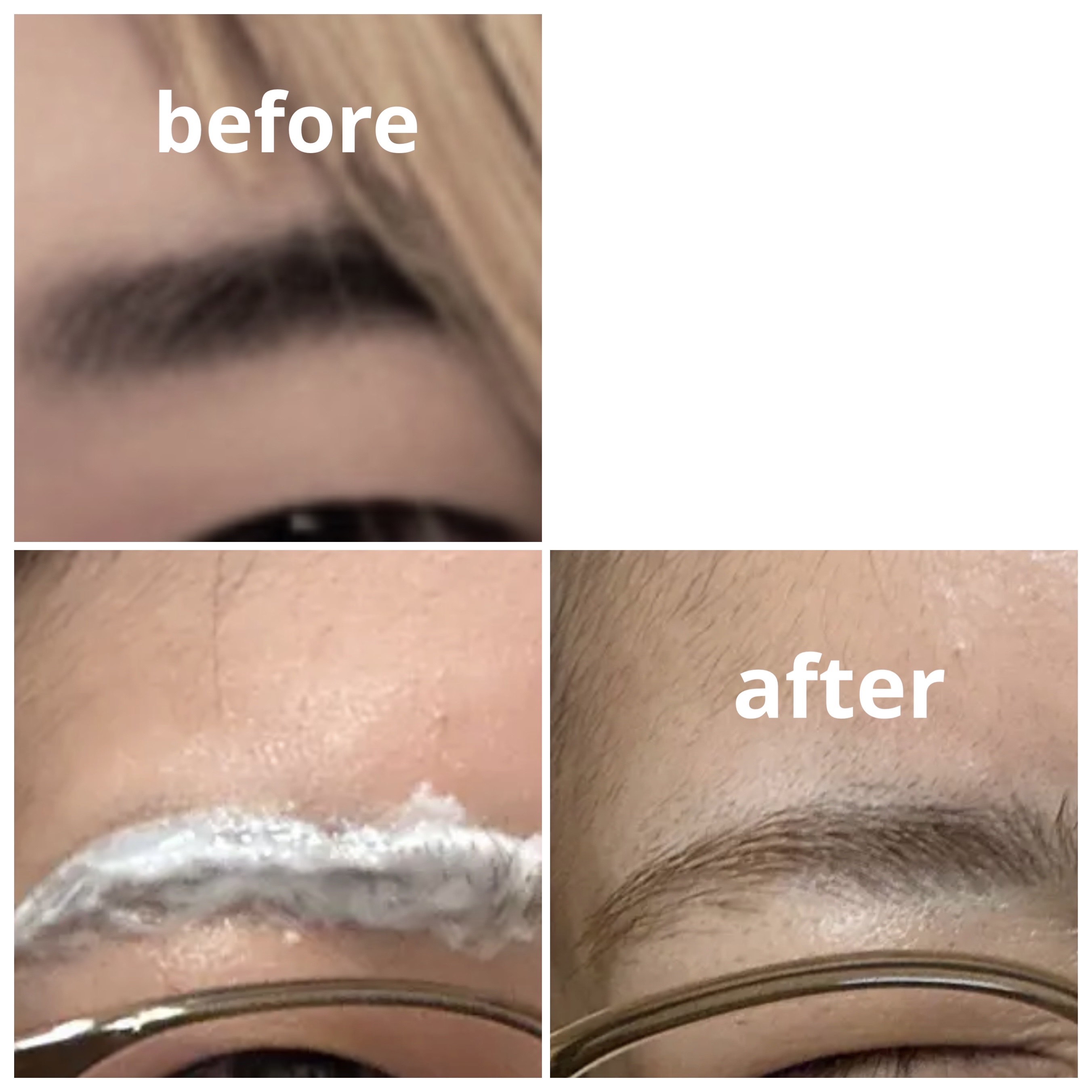 脱色クリーム スピーディー/エピラット/ムダ毛ケアを使ったクチコミ（2枚目）