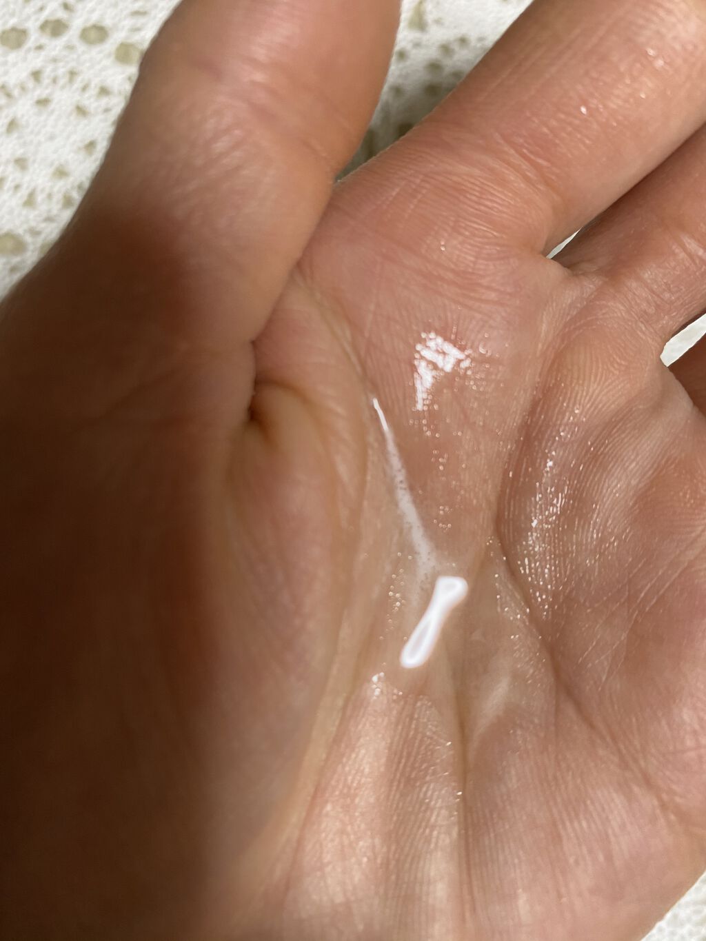 薬用スカルプエッセンス/HAIRICHE/頭皮ローションを使ったクチコミ（3枚目）