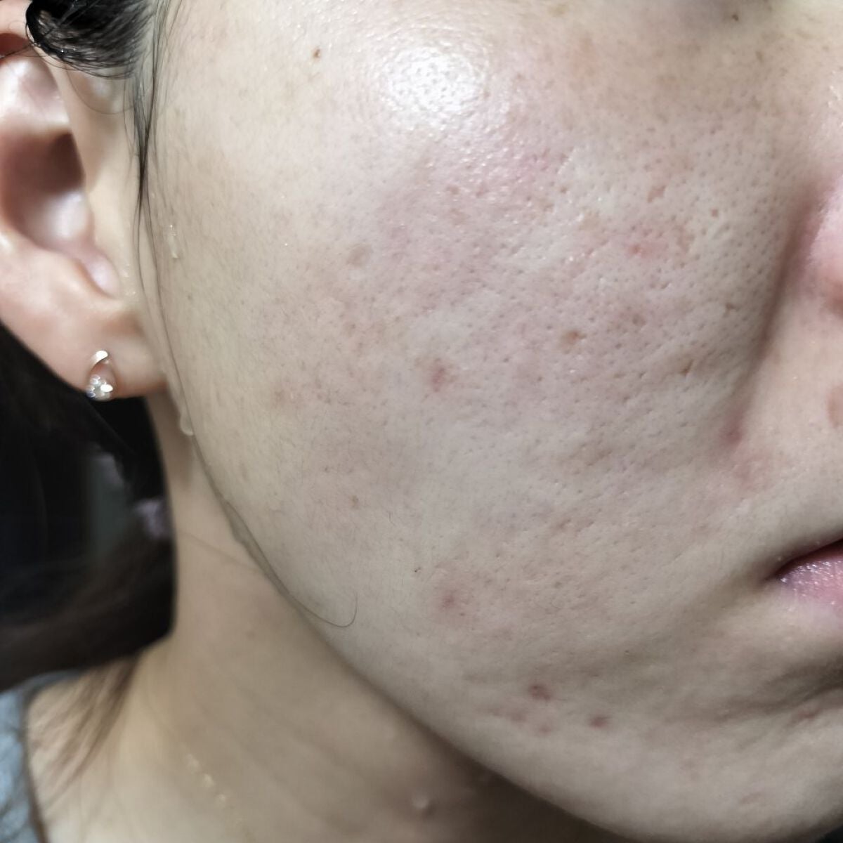 LA10+HAフェイスセラム/The Ordinary/ピーリングを使ったクチコミ(1枚目)