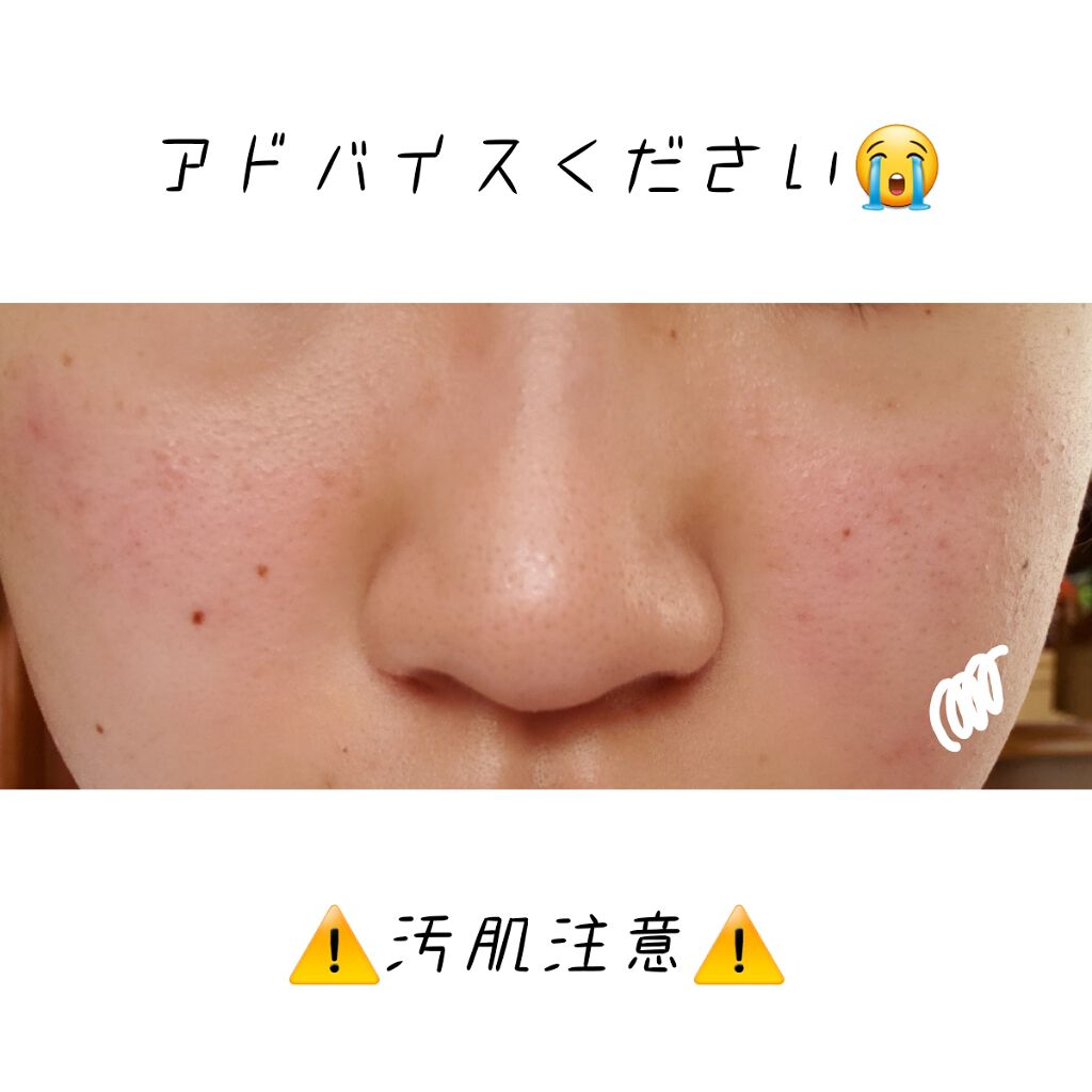 ハトムギ化粧水(ナチュリエ スキンコンディショナー R )/ナチュリエ/化粧水を使ったクチコミ（1枚目）