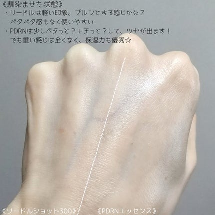 リードルショット300/VT/美容液を使ったクチコミ(8枚目)