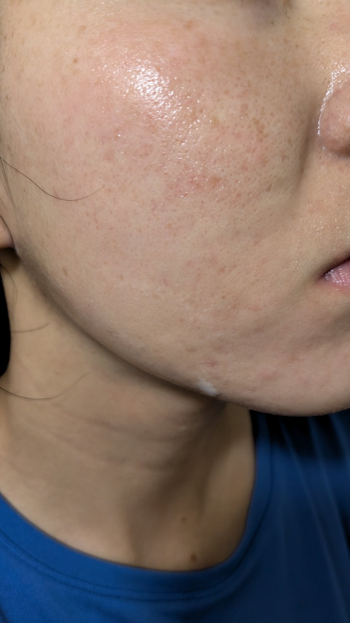 A2+NAG2ソリューション/The Ordinary/美容液を使ったクチコミ（1枚目）