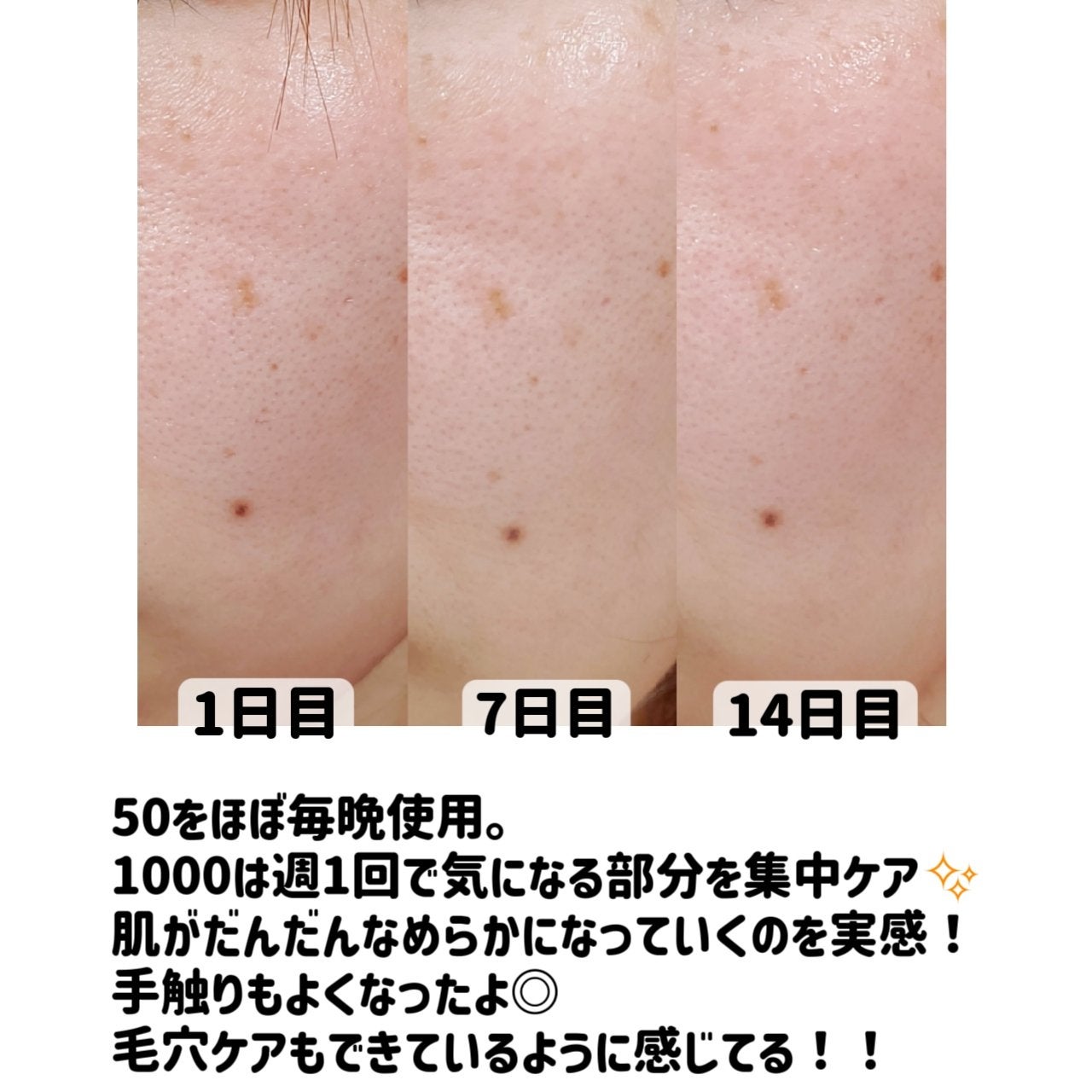 マイルドリードルショット50/VT/美容液を使ったクチコミ(8枚目)