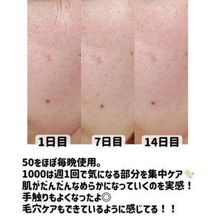 マイルドリードルショット50/VT/美容液を使ったクチコミ(8枚目)