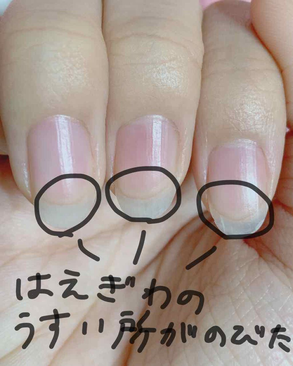 キューティクルトリートメントオイル/DHC/ネイルオイル・トリートメントを使ったクチコミ（2枚目）