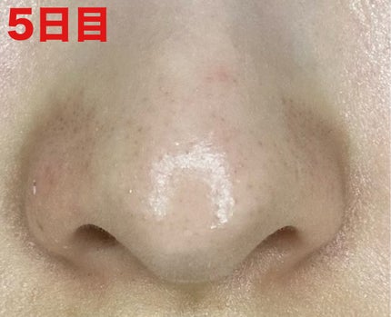 3番 緑茶炭毛穴パッククレンジングバーム/numbuzin/クレンジングバームを使ったクチコミ(2枚目)