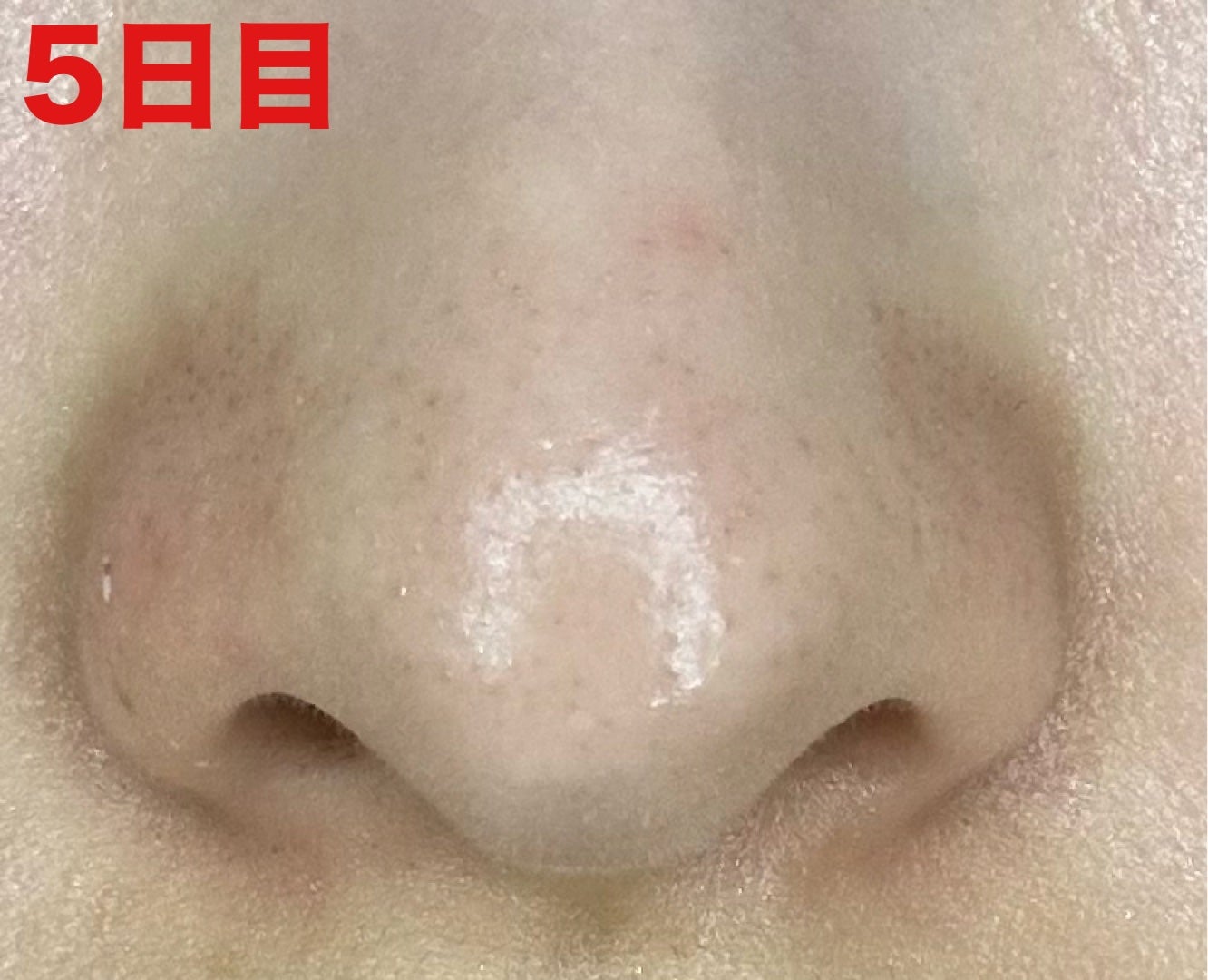 3番 緑茶炭毛穴パッククレンジングバーム/numbuzin/クレンジングバームを使ったクチコミ(7枚目)