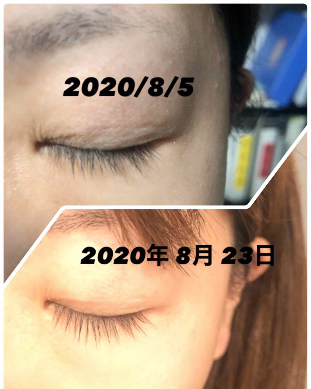 ラッシュ セラム/ロレアル パリ/まつげ美容液を使ったクチコミ（1枚目）