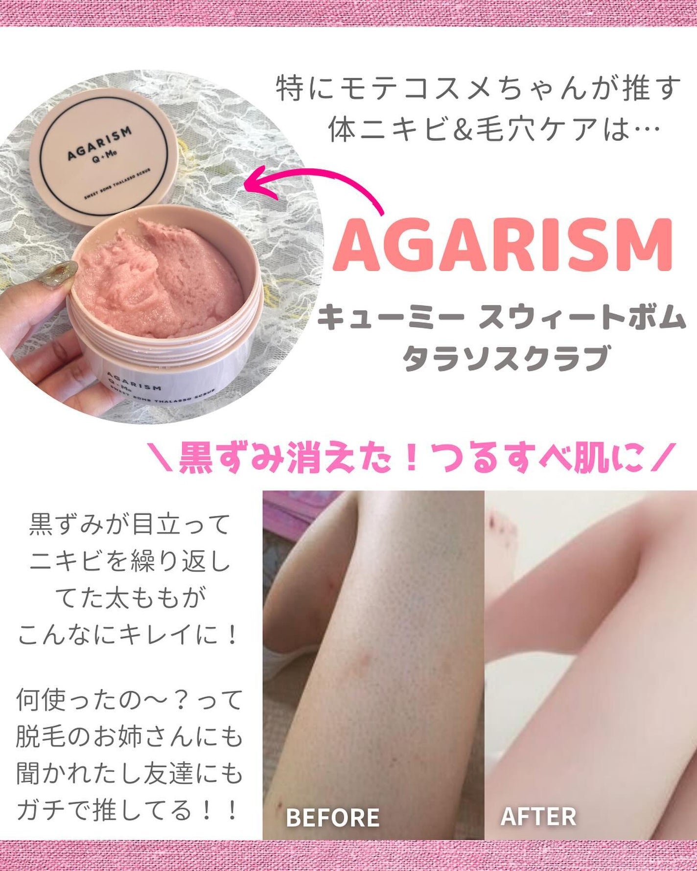 薬用ふきとり美容シート/オードムーゲ/拭き取り化粧水を使ったクチコミ(6枚目)