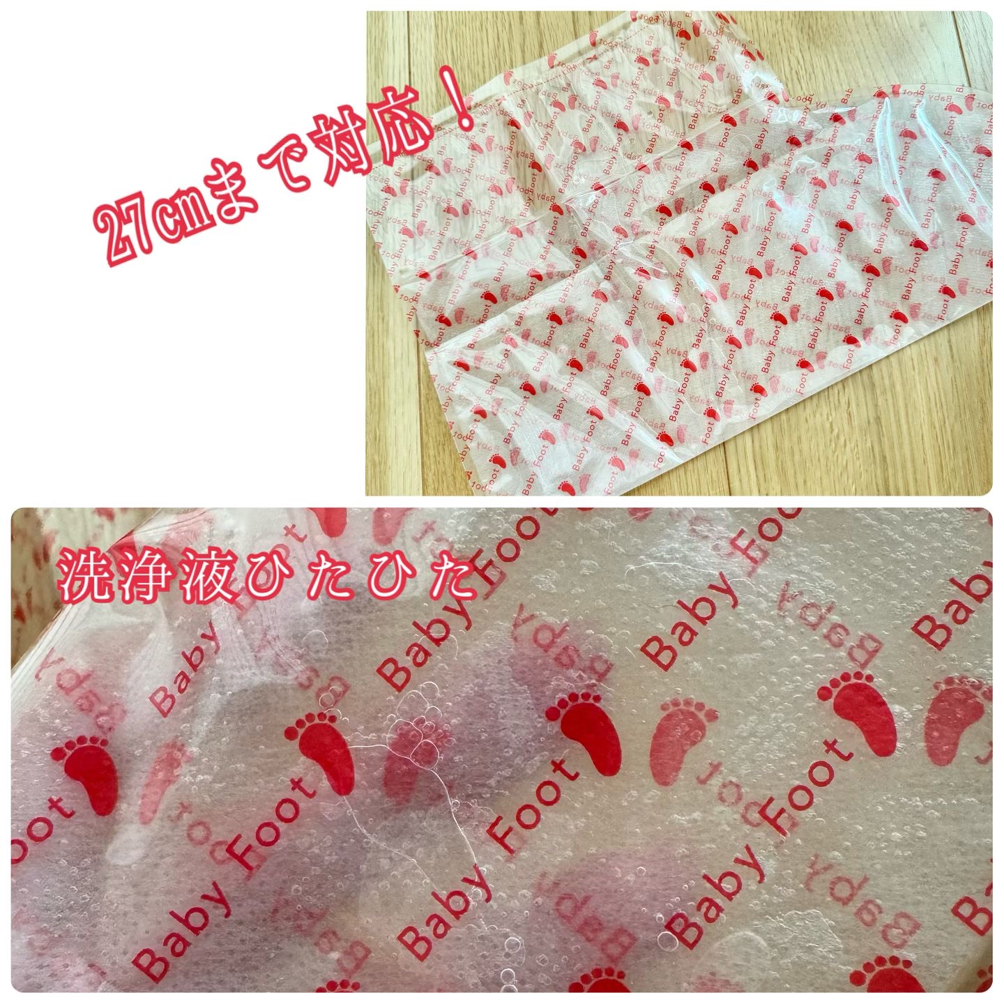 ベビーフット 重曹殺菌消毒洗浄剤/ベビーフット/レッグ・フットケアを使ったクチコミ（3枚目）