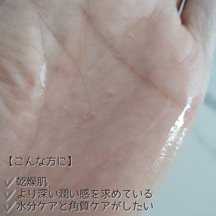 アクアヒアルロニックエッセンス/ロベクチン/化粧水を使ったクチコミ(4枚目)