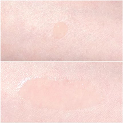 ニキビあとケアジェル/アットノン/その他スキンケアを使ったクチコミ(9枚目)