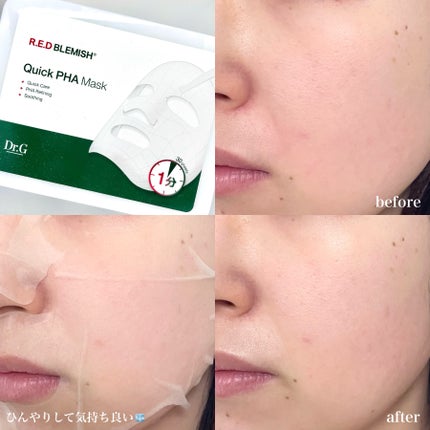 レッドブレミッシュ リペアスージングクリーム/Dr.G/フェイスクリームを使ったクチコミ(3枚目)