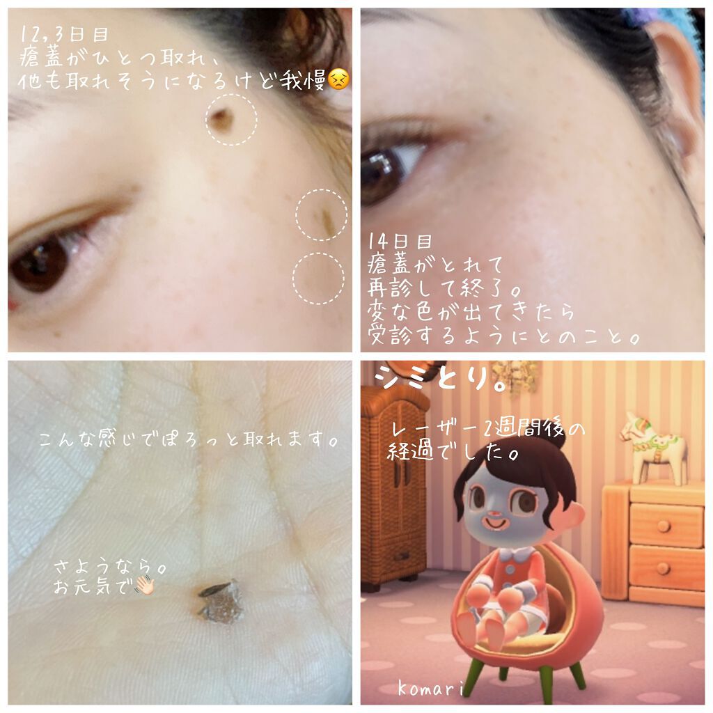 を使ったクチコミ（2枚目）