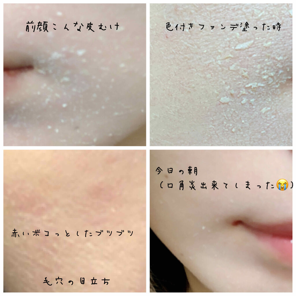 ミラミン/ZO Skin Health/フェイスクリームを使ったクチコミ（3枚目）