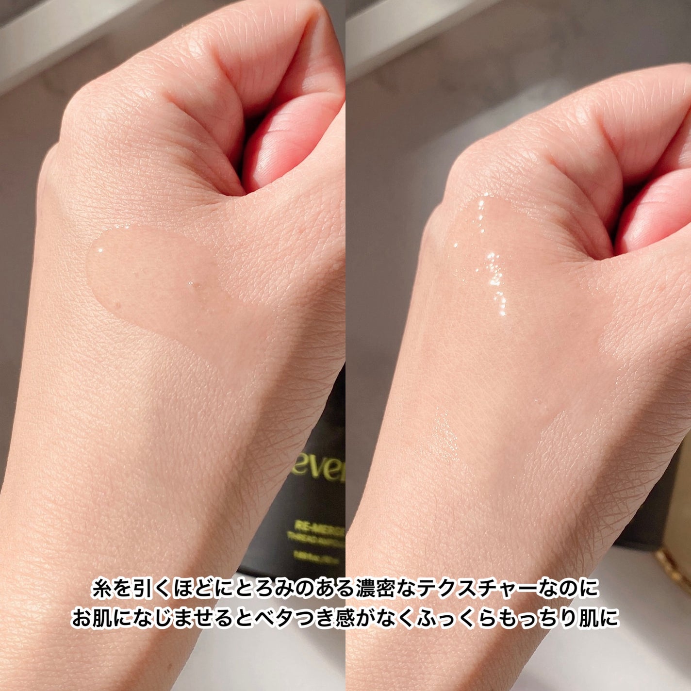 リマージ糸リフティングアンプル/REVENIP/美容液を使ったクチコミ(4枚目)