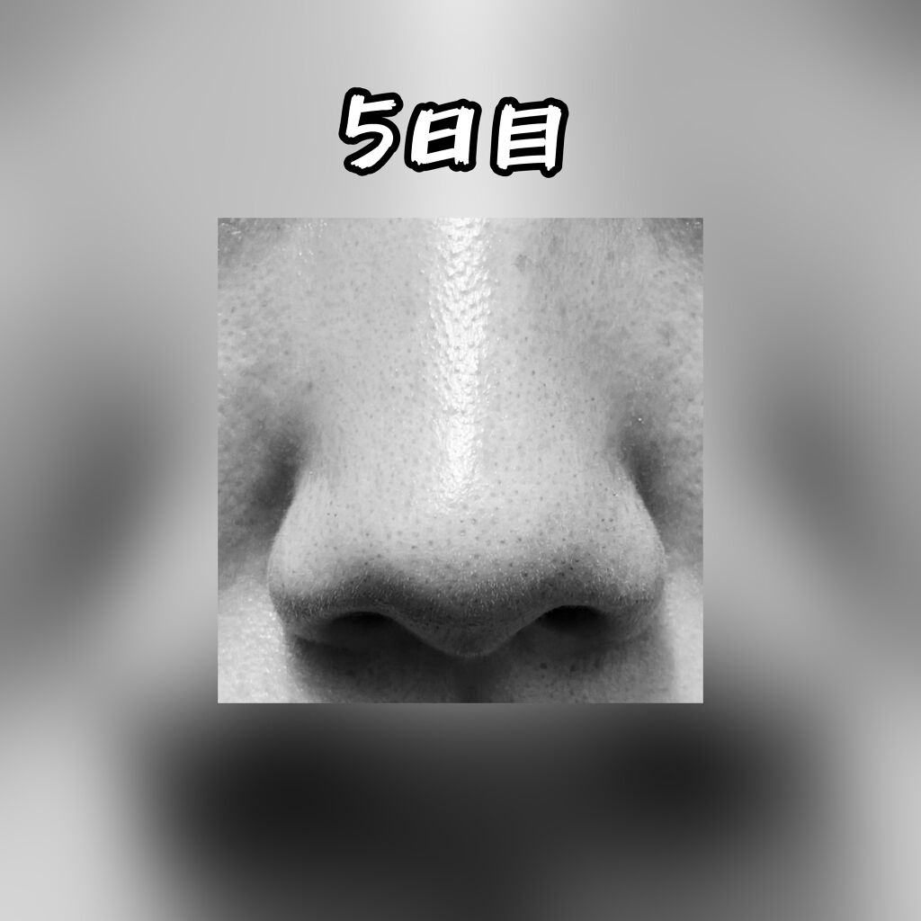 シラクル ビューティシート/Ciracle/トナーパッドを使ったクチコミ（3枚目）