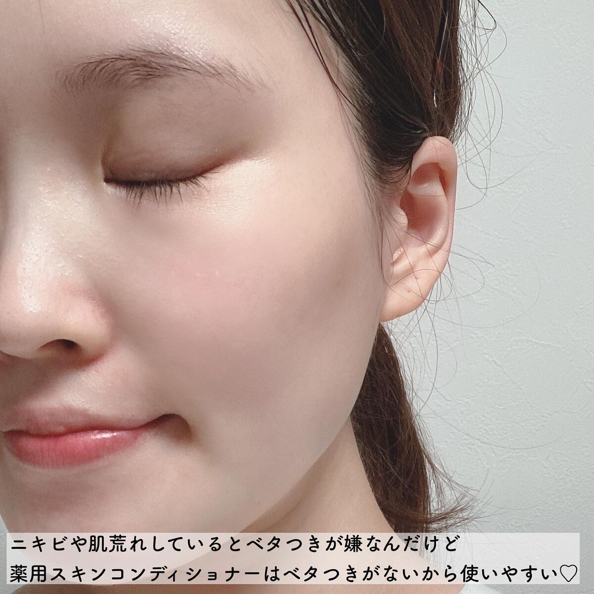 薬用スキンコンディショナー/chant a charm /化粧水を使ったクチコミ(3枚目)