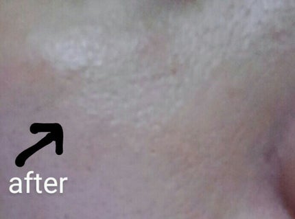 ホワイトカバースティック/shimaboshi/化粧下地を使ったクチコミ(9枚目)