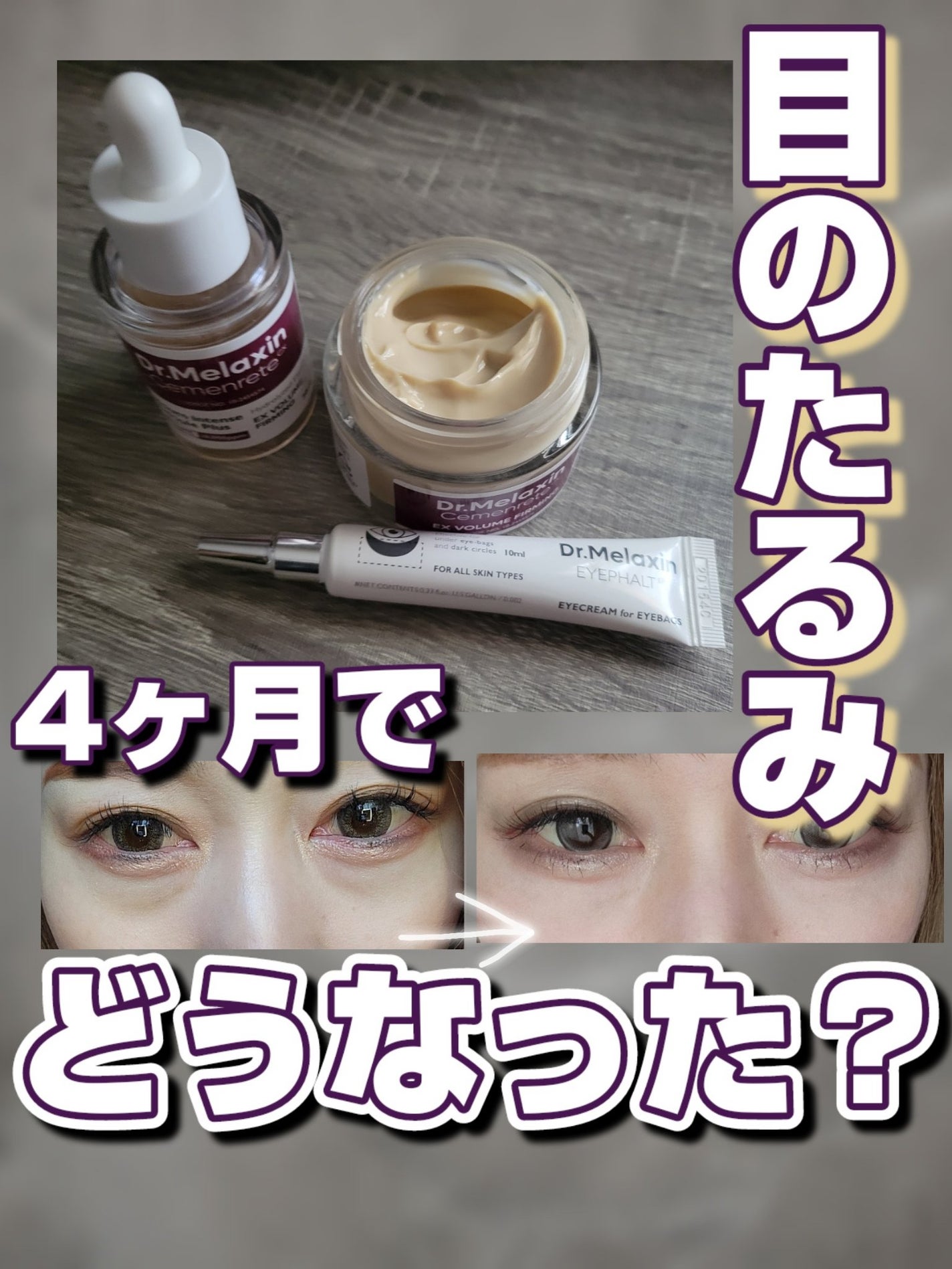 Cemenrete Calcium Intense Cream/Dr.Melaxin/フェイスクリームを使ったクチコミ(1枚目)