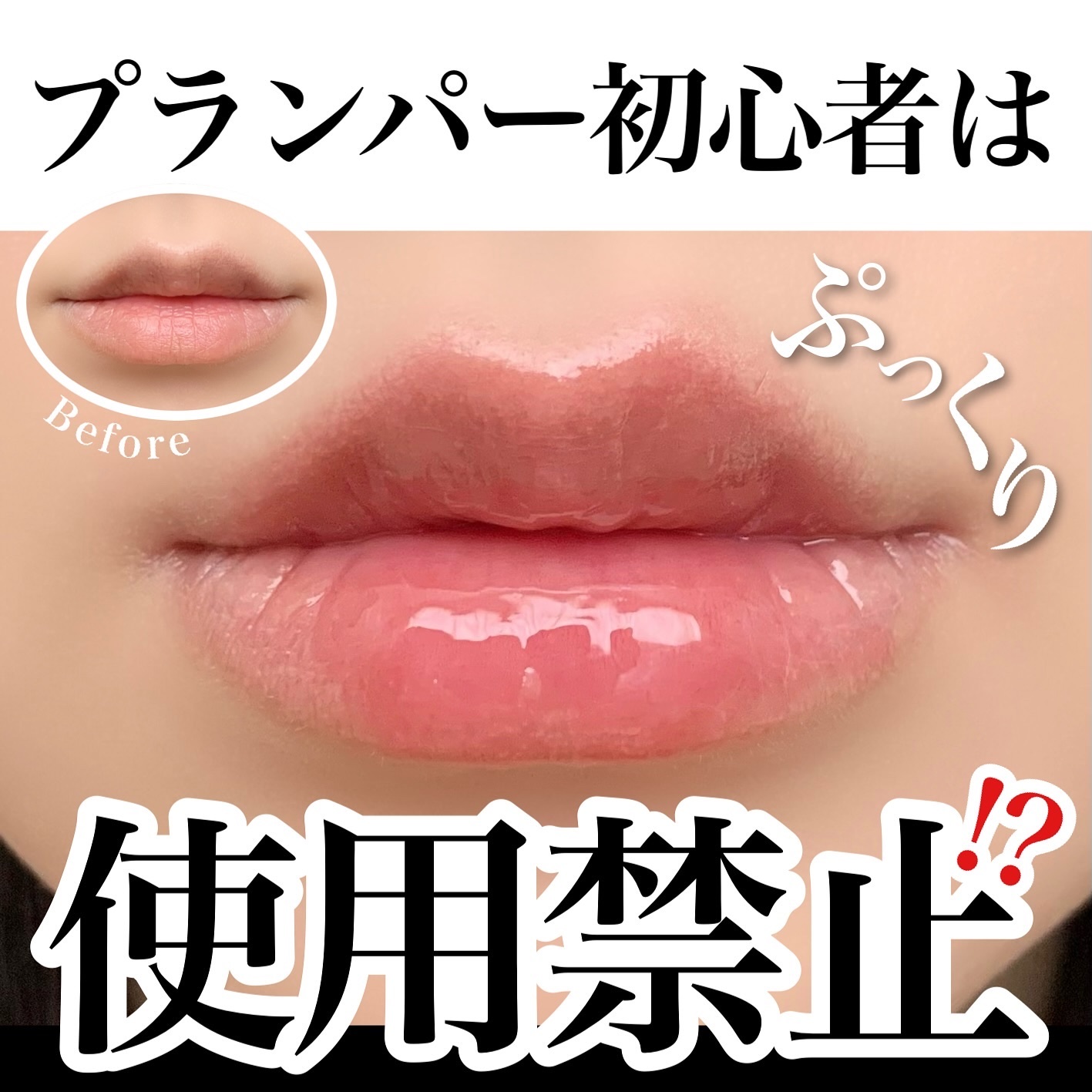 ボリュームリッププランパー/BANILA CO/リッププランパーを使ったクチコミ（1枚目）