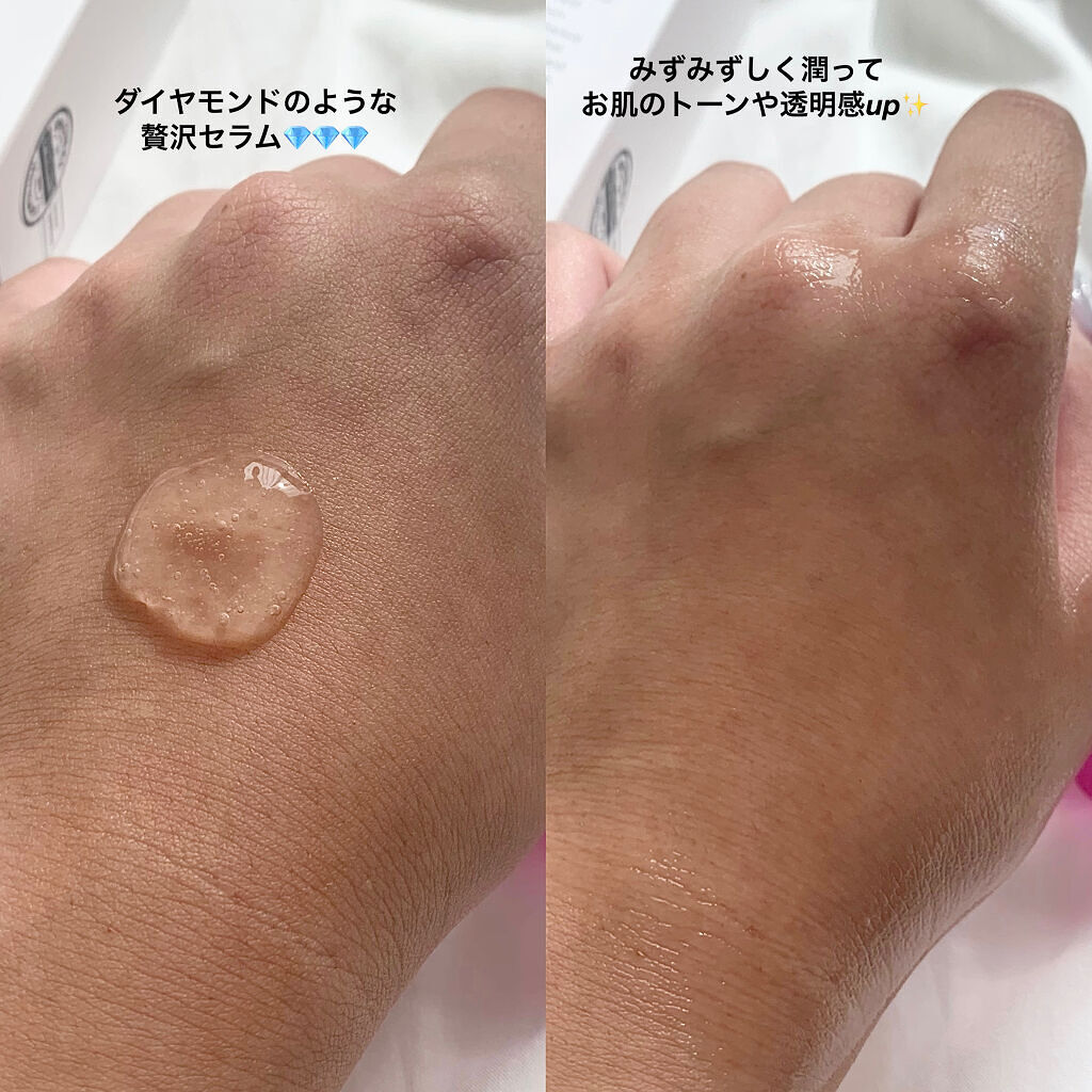 ブレミッシュケアアップ セラム/ISOI/美容液を使ったクチコミ（2枚目）