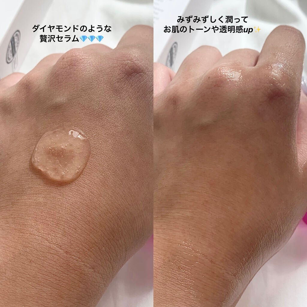 ブレミッシュケアアップ セラム/ISOI/美容液を使ったクチコミ(2枚目)