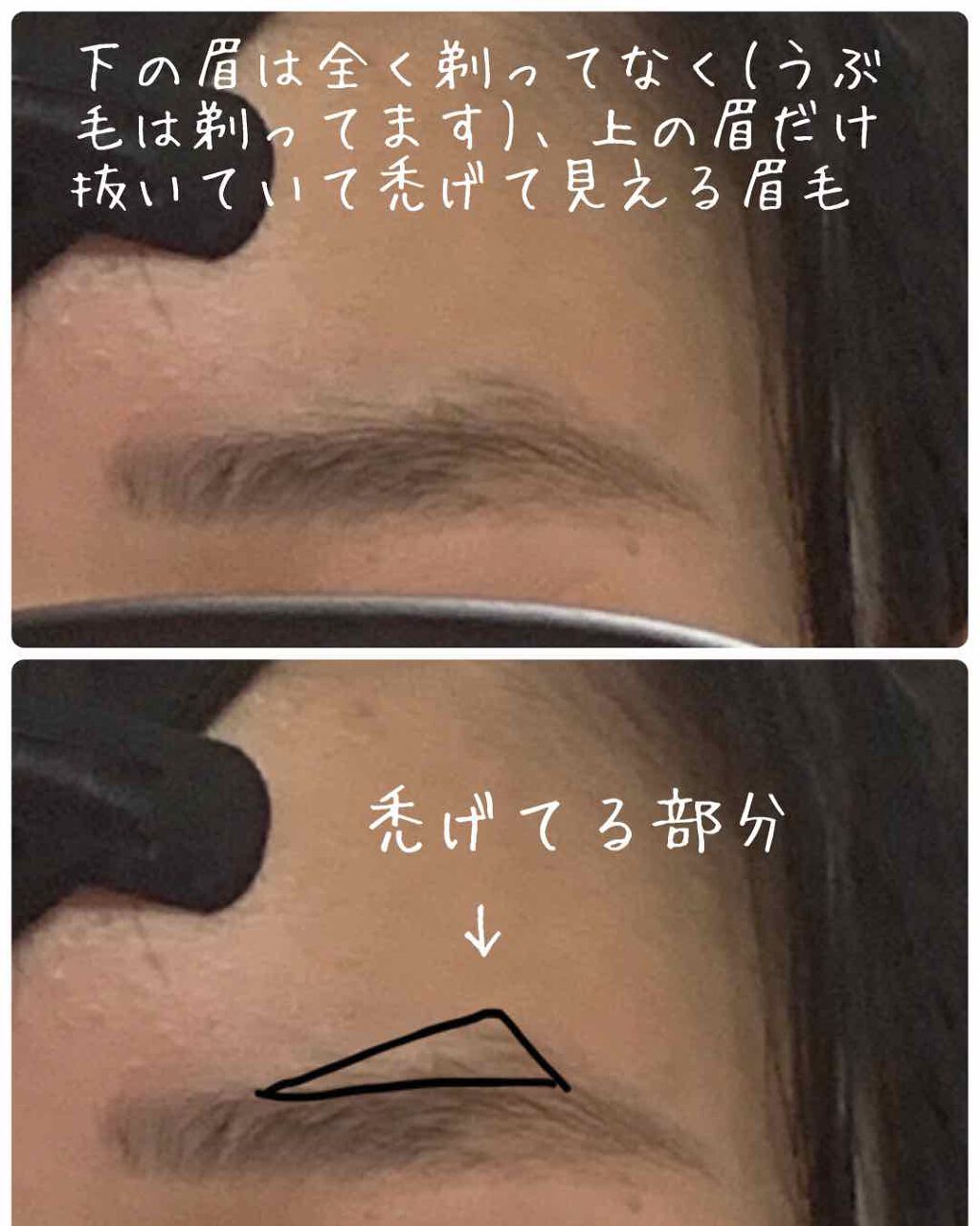 極潤 ヒアルロン乳液(旧)/肌ラボ/乳液を使ったクチコミ（3枚目）