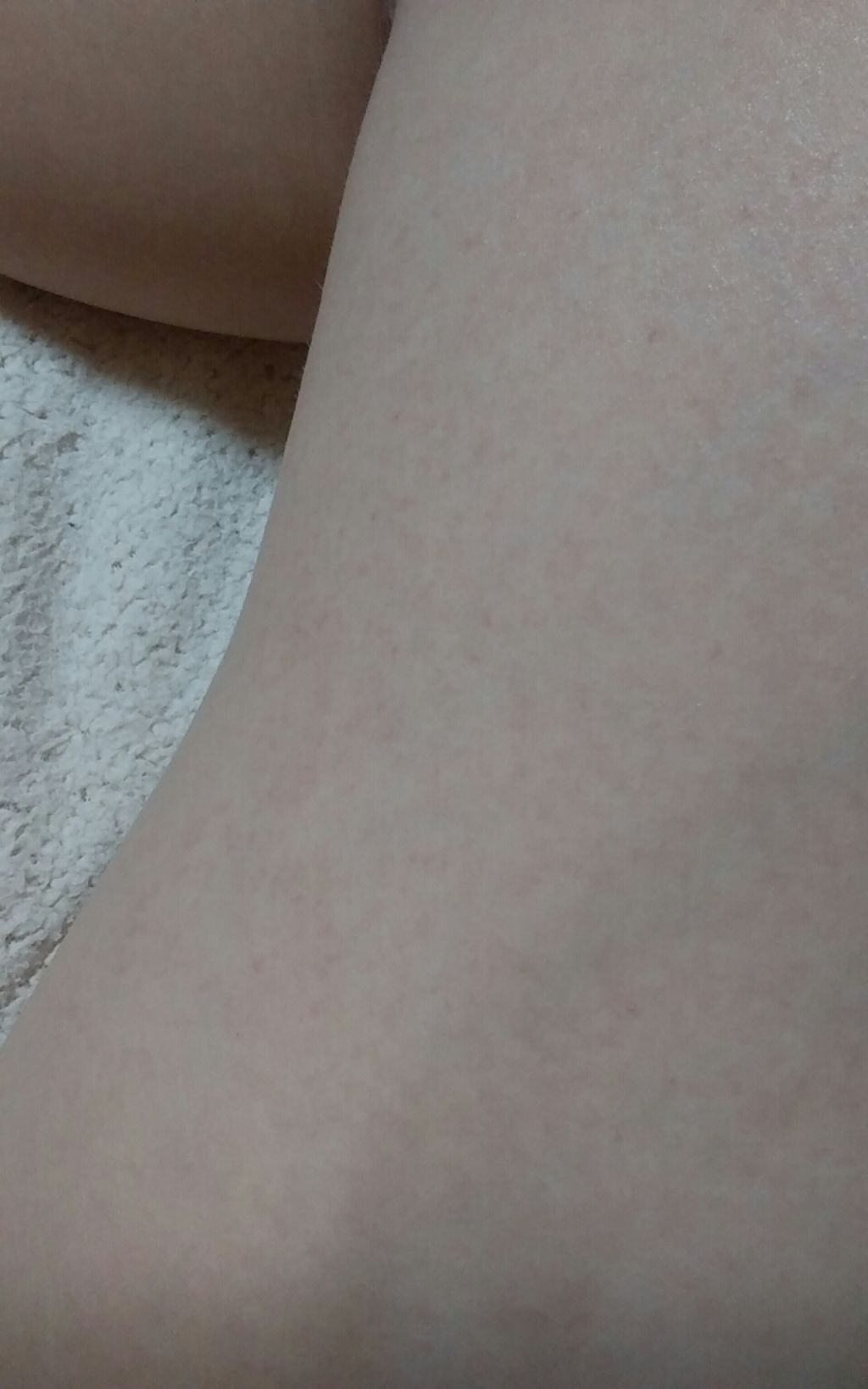 ko_ha. on LIPS 「皆さん2枚目からの画像は私の足なのですが、太ももに赤っぽい色も..」(3枚目)