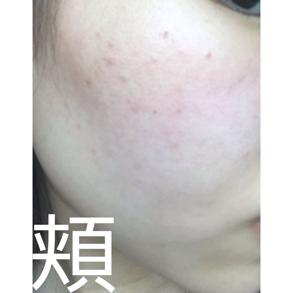 サンシビオ エイチツーオー D/ビオデルマ/クレンジングウォーターを使ったクチコミ(5枚目)