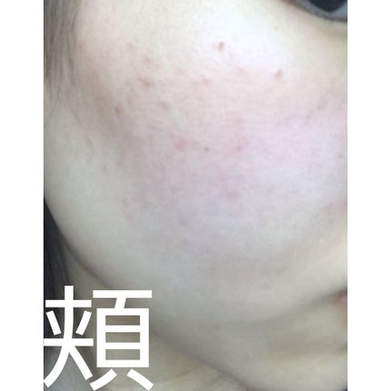 サンシビオ エイチツーオー D/ビオデルマ/クレンジングウォーターを使ったクチコミ(5枚目)