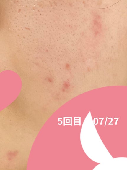 もち肌コラーゲンセラム3.0/MEDICUBE/美容液を使ったクチコミ(2枚目)