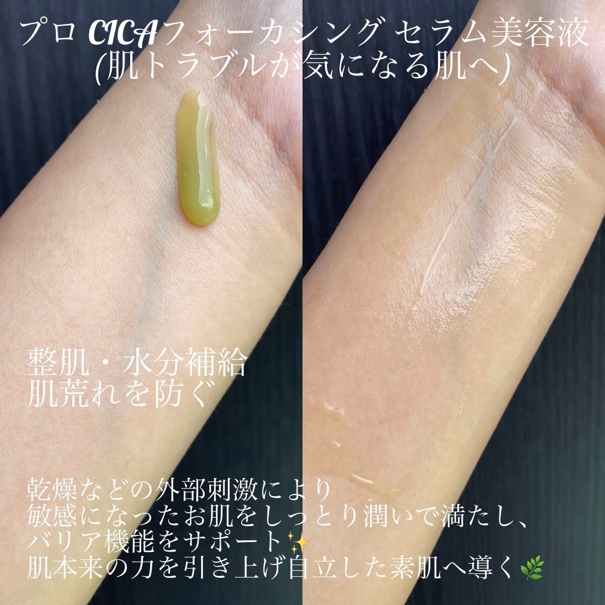 プロ シカ センテラ アジアティカ タイガー スキン/VT/化粧水を使ったクチコミ(7枚目)