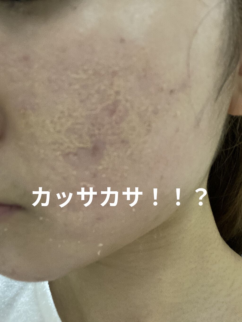 スポッツカバー ファウンデイション/SHISEIDO/クリームコンシーラーを使ったクチコミ（2枚目）