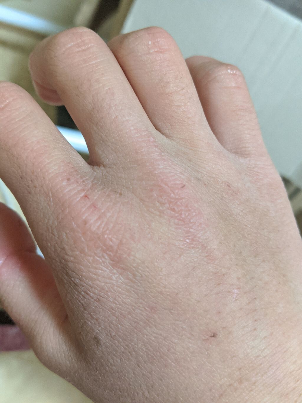 「間宮」アロエ軟膏 (医薬品)/アロエ製薬/その他を使ったクチコミ(1枚目)