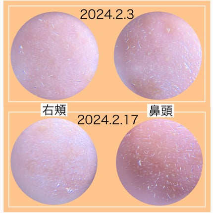 リードルショット100/VT/美容液を使ったクチコミ(5枚目)