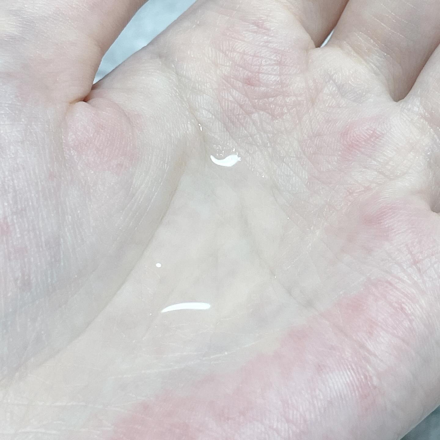 エファクラ ピールケア セラム/ラ ロッシュ ポゼ/美容液を使ったクチコミ（3枚目）