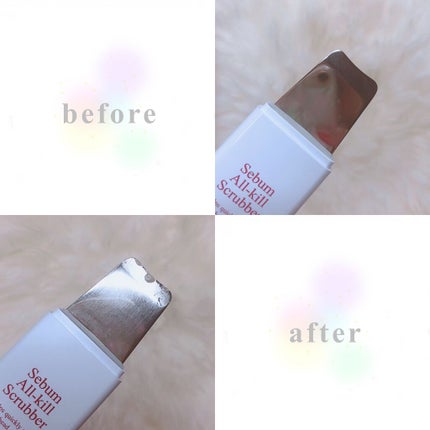 皮脂キラー/RoRoBELL/ピーリングを使ったクチコミ(3枚目)