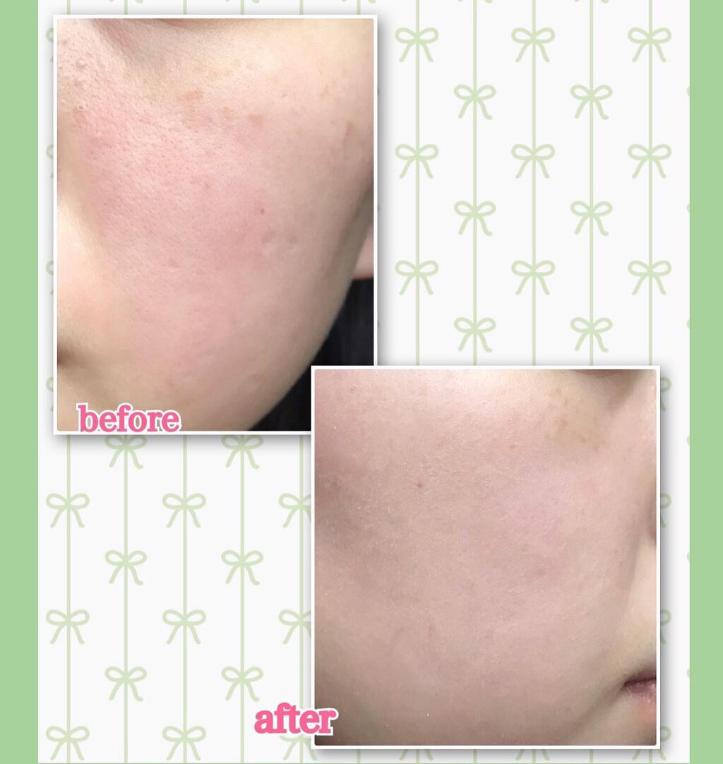 アマールカ BBクリーム/カリプソ/BBクリームを使ったクチコミ(3枚目)