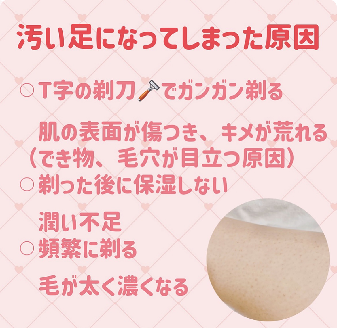 bi-hada ompa L ホルダー替刃2個付/貝印/シェーバーを使ったクチコミ（3枚目）