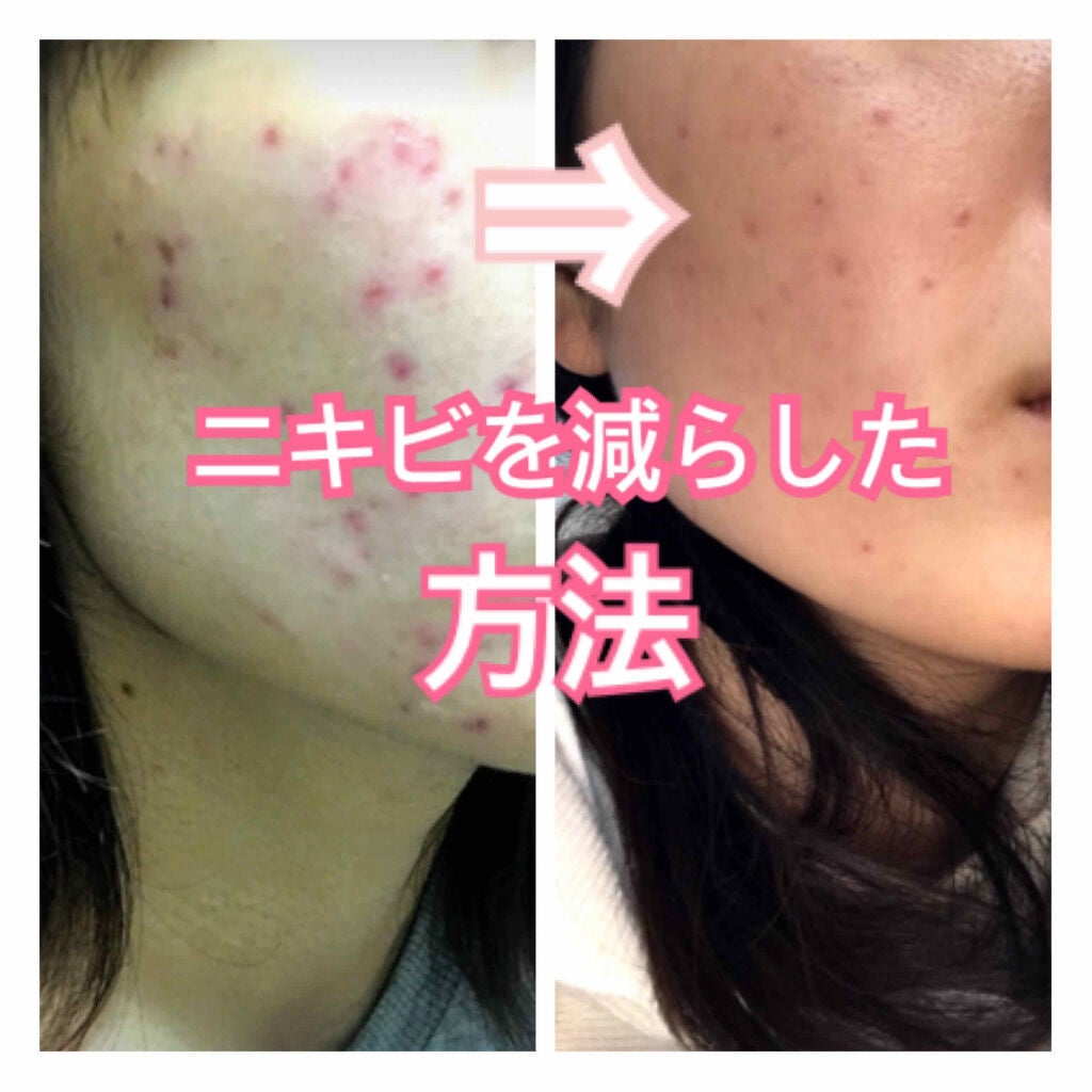 アルビオン 薬用スキンコンディショナー エッセンシャル/ALBION/化粧水を使ったクチコミ(1枚目)