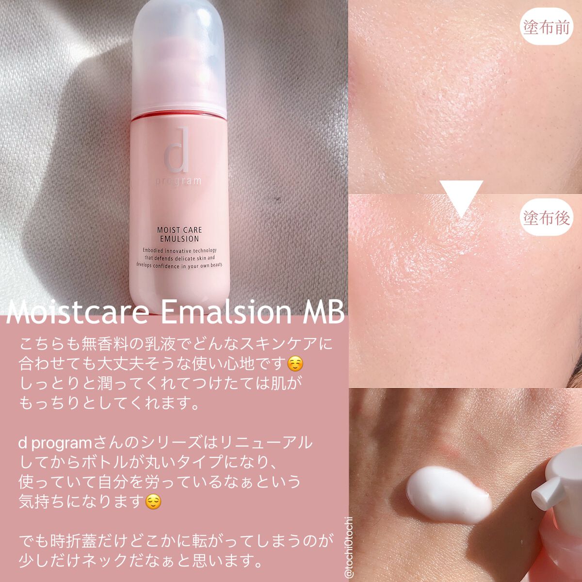 アレルバリア ミスト/d プログラム/ミスト状化粧水を使ったクチコミ（3枚目）