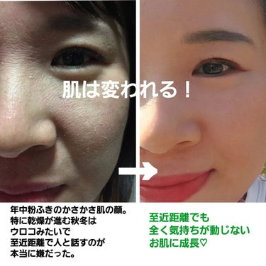 美肌カウンセラー💆綺麗のお助け相談所 on LIPS 「肌は変われる！もし変われない…って思ってるならそれはスキンケア..」（2枚目）