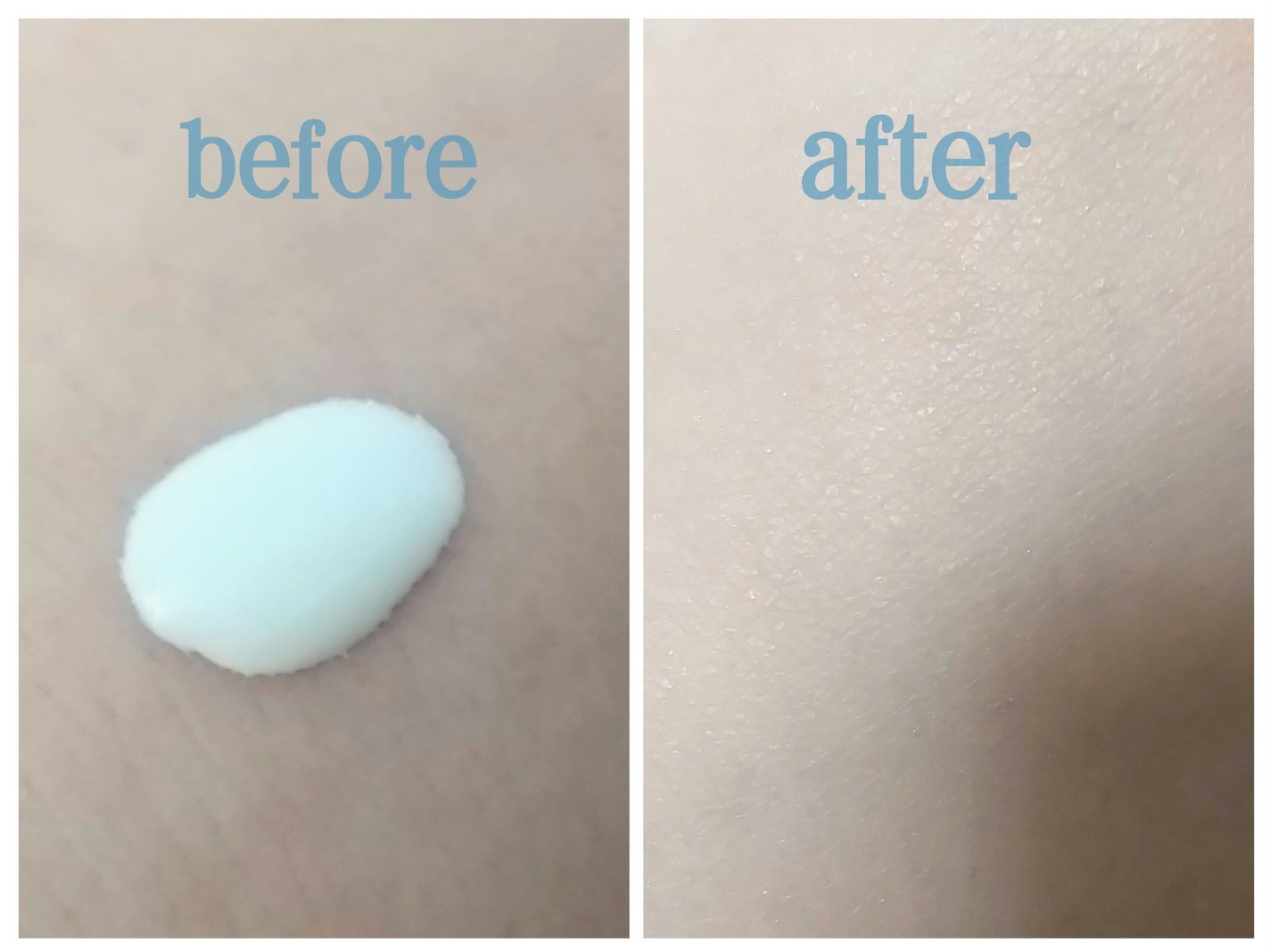 ããªã¬UVãã¢ã¯ã¢ãªãããã¢ã¯ã¢ãã€ã©ã€ãããŒã·ã§ã³ïŒæ°Žå±€ãã€ã©ã€ãUVïŒ/ããªã¬/æ¥çŒãæ¢ãããŒã·ã§ã³ã䜿ã£ãã¯ãã³ãïŒ2æç®ïŒ