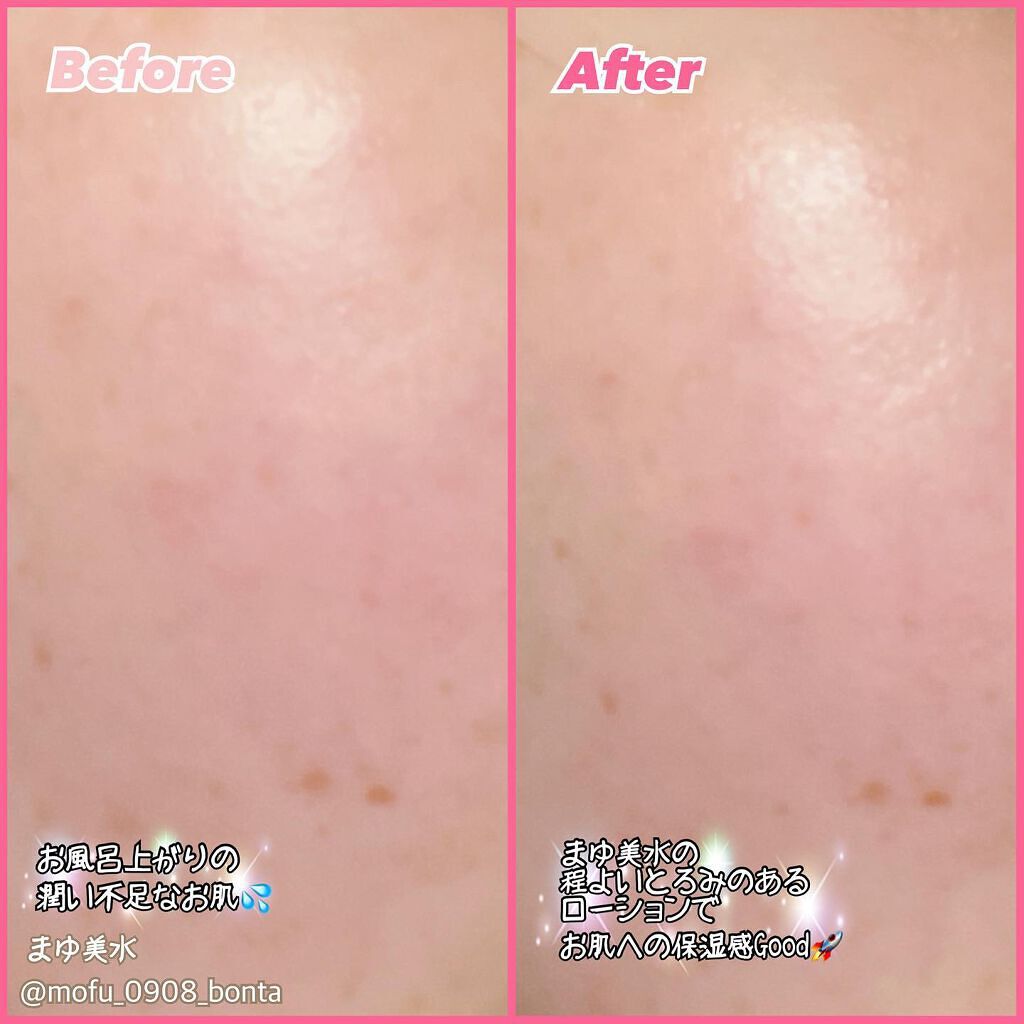 まゆ美水 ローション/シャルマン/化粧水を使ったクチコミ(3枚目)