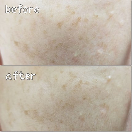 トーンショットクリーム/アバンタイム/フェイスクリームを使ったクチコミ(4枚目)