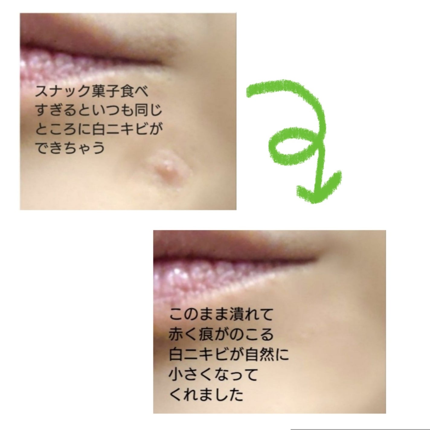 Noni Ampule/celimax/美容液を使ったクチコミ(3枚目)