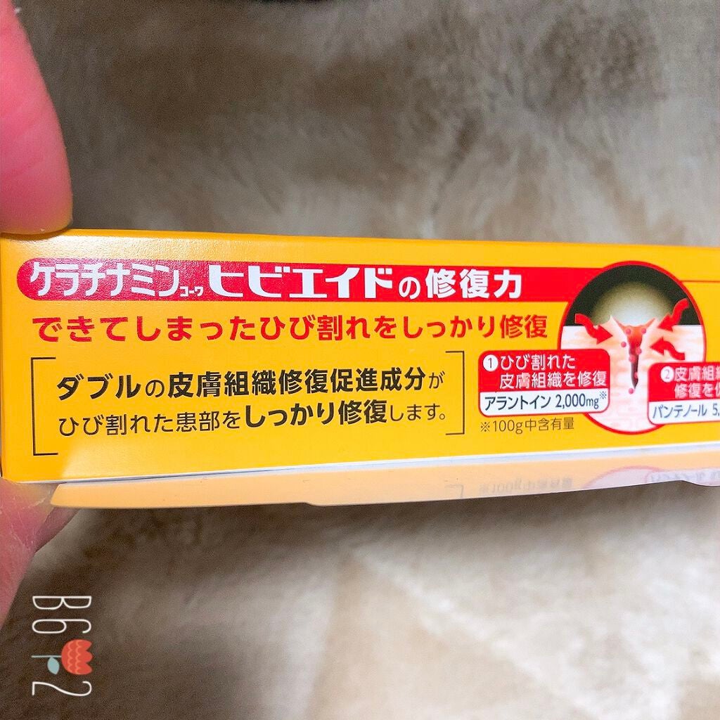 ケラチナミンコーワ ヒビエイド(医薬品)/ケラチナミン/その他を使ったクチコミ(2枚目)