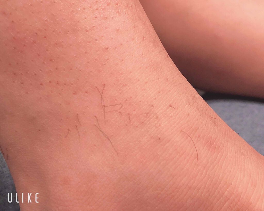 バスタイム除毛クリーム 敏感肌用 Veetの使い方を徹底解説 チクチク肌な方必見 女子にかか By M I I I 乾燥肌 Lips